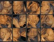 Emotional Connection